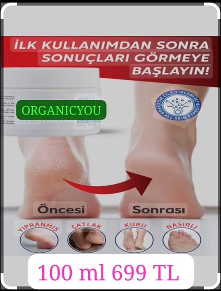 ORGANICYOU AYAK BAKIM ve ÇATLAK & KOKU BIOTERAPİ KREMİ 100 ML - 4