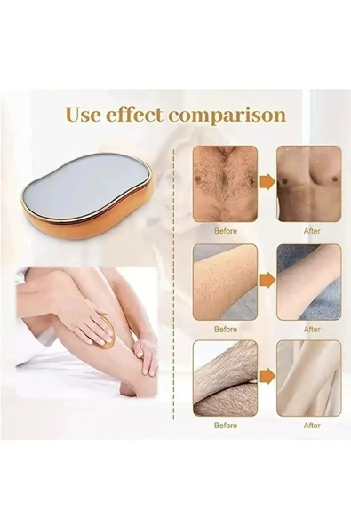 Crystal Eraser Epilasyon Aleti Tüy Silgisi Tüy Alıcı Fiziksel Kristal Epilatör - 2