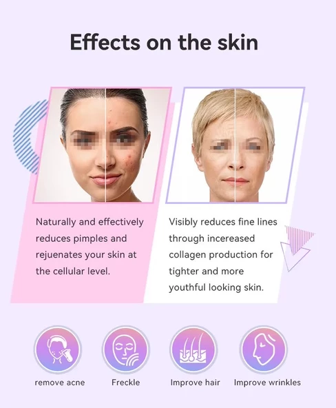 Dijital Yüksek Frekans Cihazı 6 Problu Yüz Cilt Bakım Gençleştirme Anti-Aging - 6