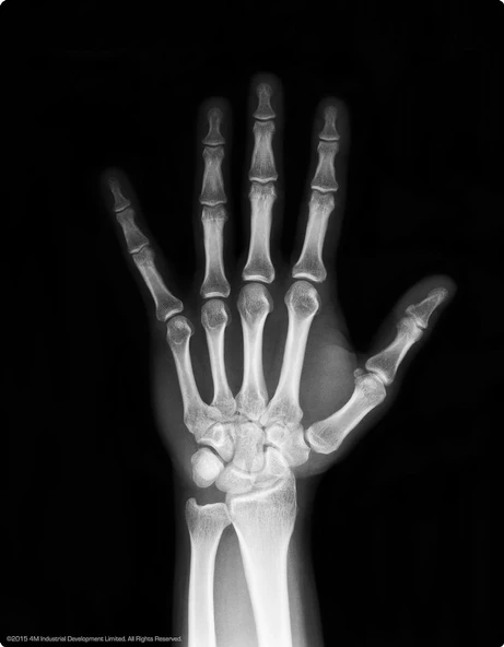 Parlayan Insan Iskeleti Magnet Seti İskelet Sistemini Öğretici Set - 3