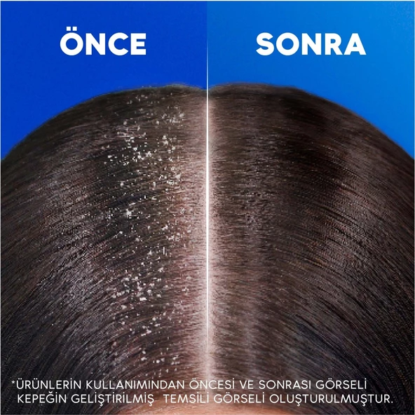 Head & Shoulders Mentol Ferahlığı 2si1 Arada Kepeğe Karşı Etkili Şampuan 330ML - 6
