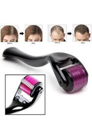 OMAC Titanyum Uçlu 540 Iğneli Derma Roller 1 Mm Iğne Cilt Yüz Vücut Yenileme Masaj Aleti - 2