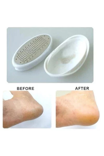 Bibizde Ayak Topuk Törpüsü Ayak Peelingi Topuk Temizleyici Törpü Ped Egg - 3