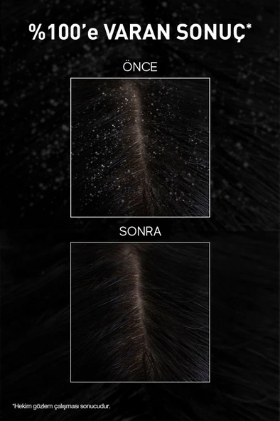 Bioxcin Aquathermal Ds 200 ML + 300 ML Kepeğe Karşı Etkili Şampuan Seti - Kepek Karşıtı Kaşıntı Önleyici - 8