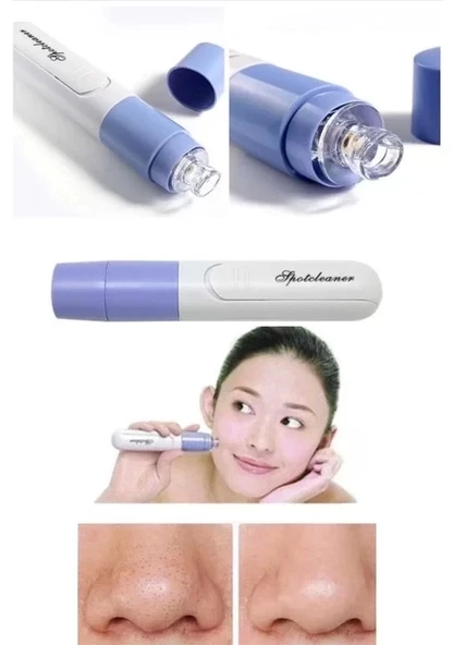 Pore Cleaner Vakumlu Yüz Temizleme Siyah Nokta Temizleme Cihazı - Resim 3