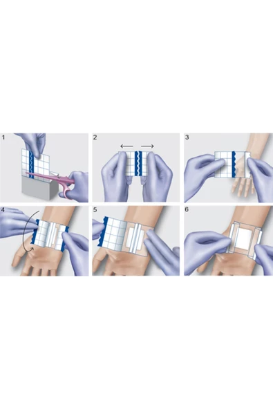 Hydrofilm Roll 15cm X 10m Su Geçirmez Film Örtü - 2