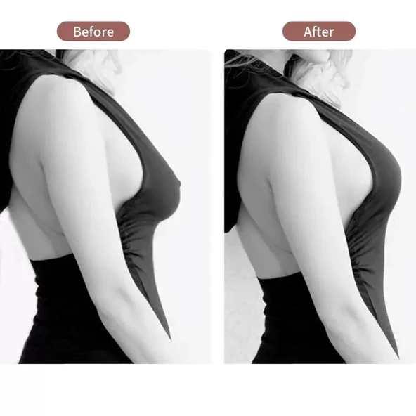 Göğüs Dikleştirme Bandı S Beden 2.5 Cm. - Resim 2