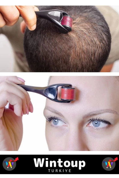 Yüksek Kaliteli 0.5 Mm 540 Titanyum İğneli Cilt Yenileyici Pürüzsüz Cilt Bakım Aleti Derma Roller - 3