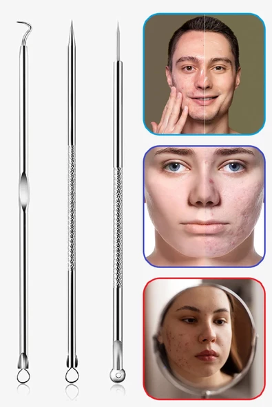 8 Fonksiyonlu Sivilce, Akne, Yüz Bakımı, Siyah Nokta Leke Çıkarıcı 4 lü Komedon Seti Cilt Bakım - 4