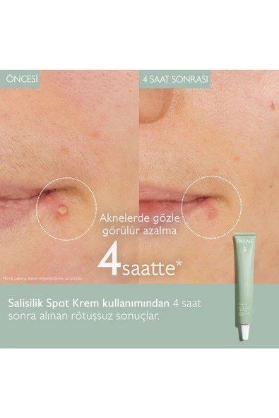 Caudalie Vinopure Salisilik Spot Krem 15 Ml