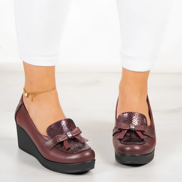 Erkan Saçmacı Emma Bordo Hakiki Deri Dolgu Topuklu Günlük Ayakkabı - Resim 4