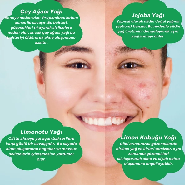 ANTI-ACNE CARE OIL Akne Karşıtı Cilt Bakım Yağı - 4