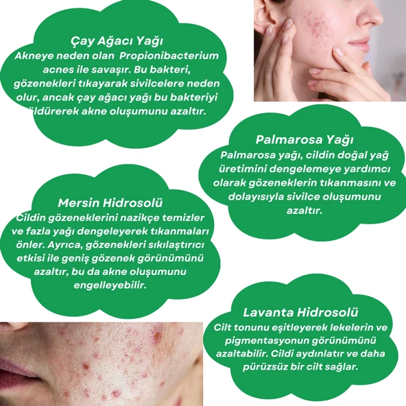 ANTI-ACNE TONER Çay Ağacı ve Palmarosa Özlü Cilt Bakım Suyu - 4