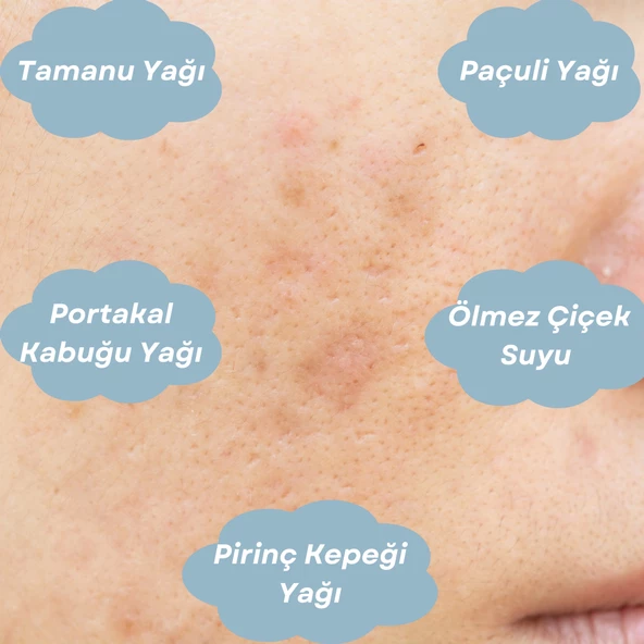 ANTI-BLEMISH SERUM Leke Giderici Cilt Bakım Serumu - 4