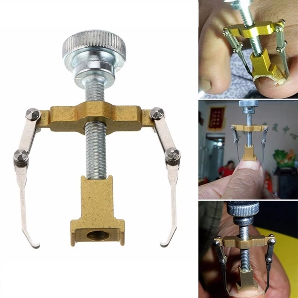 Profesyonel Batık Tırnağı Düzeltme Aparatı - 2