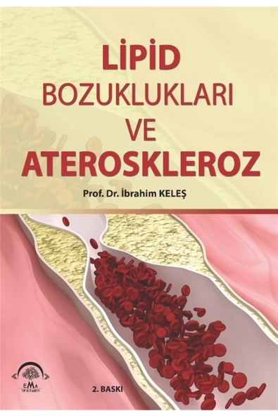 Lipid Bozuklukları Ve Ateroskleroz - Ibrahim Keleş 9786058469938