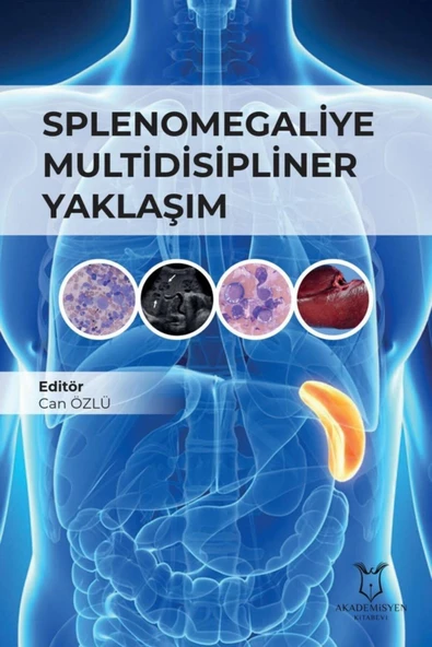 Splenomegaliye Multidisipliner Yaklaşım