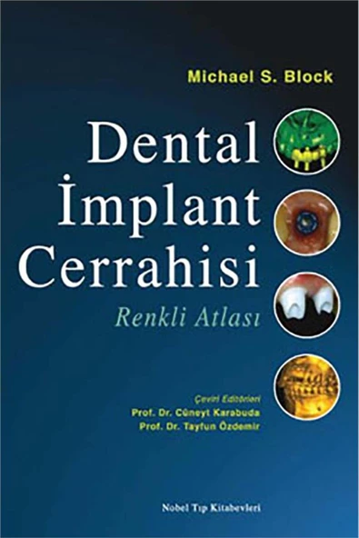 Dental İmplant Cerrahisi Renkli Atlası