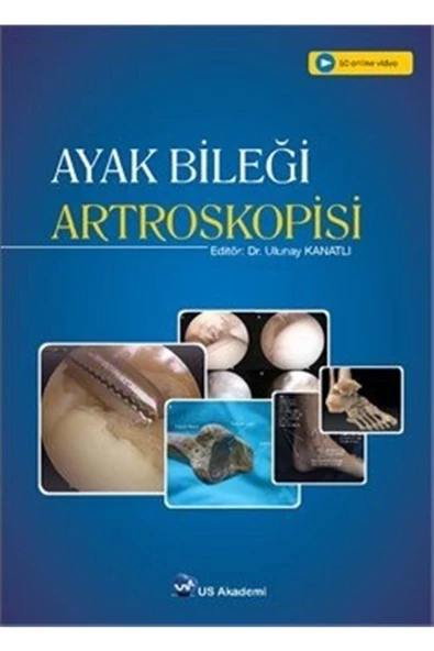 Ayak Bileği Artroskopisi