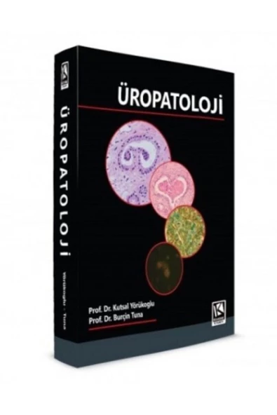 Üropatoloji
