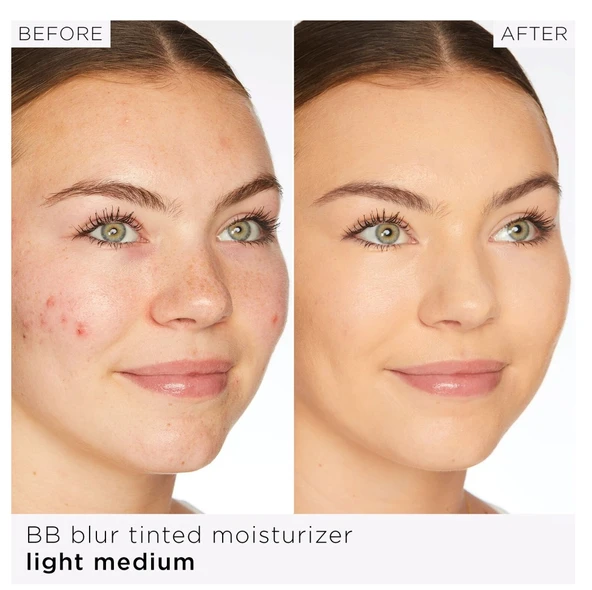 TARTE BB Blur Tinted Moisturizer Light-medium - Renkli Nemlendirici Krem 30 ml - 3