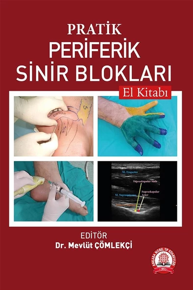 Pratik Periferik Sinir Blokları El Kitabı