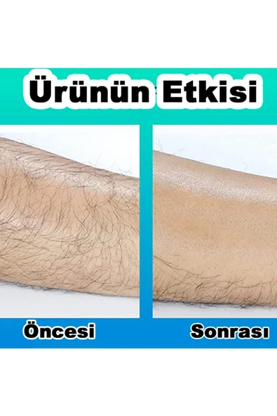 ONULISS Kristal Epilatör Crystal Eraser Epilasyon Tüy Dökücü Sertifikalı - 2