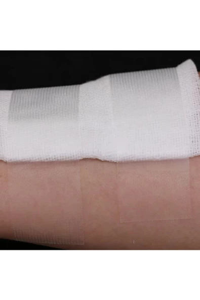 Octacare Şeffaf Polietilen Tıbbi Flaster - 5m x 5 cm ( 1 ADET ) - 3