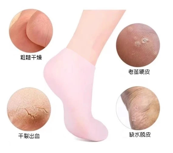 Pratik Silikon Nemlendirici Topuk Çorap Ayak Bakımı Çorap - Resim 4