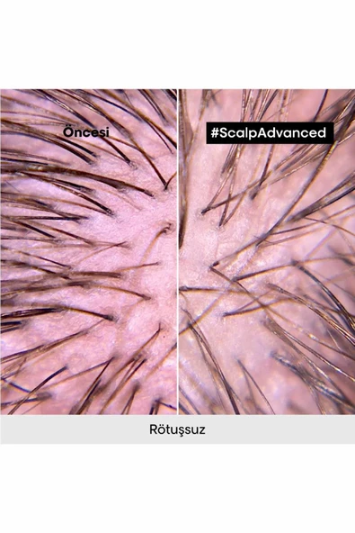 L'OREAL PROFESSİONNEL Serie Expert Scalp Advanced Hassas Saç Derisi Için Profesyonel Şampuan 500ml - 8