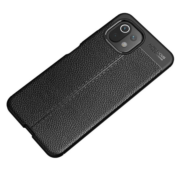 Xiaomi Mi 11 Lite Kılıf Zore Niss Deri Desenli Silikon Kılıf - 8