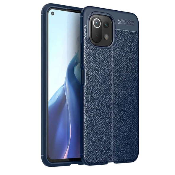 Xiaomi Mi 11 Lite Kılıf Zore Niss Deri Desenli Silikon Kılıf - 3
