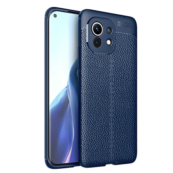 Xiaomi Mi 11 Kılıf Zore Niss Deri Desenl Silikon Kılıf - 3