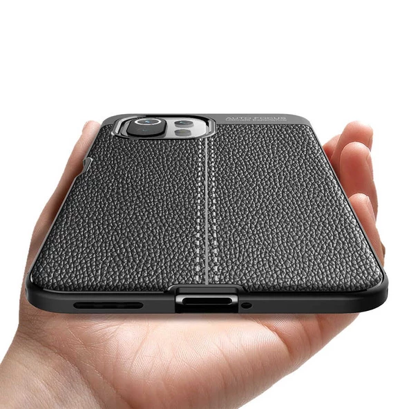 Xiaomi Mi 11 Lite Kılıf Zore Niss Deri Desenli Silikon Kılıf - 6