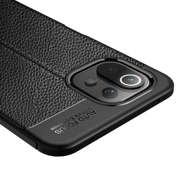 Xiaomi Mi 11 Lite Kılıf Zore Niss Deri Desenli Silikon Kılıf - 12
