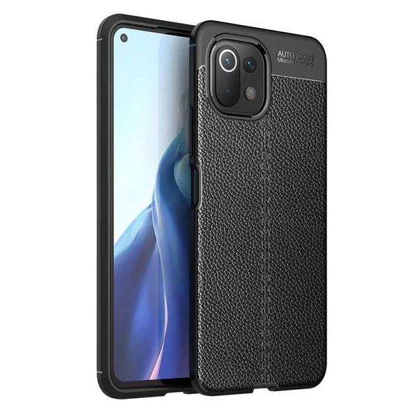 Xiaomi Mi 11 Lite Kılıf Zore Niss Deri Desenli Silikon Kılıf - 2