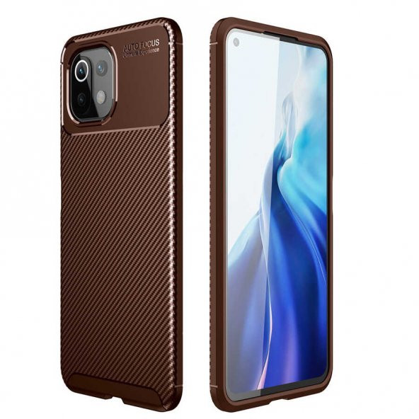 Xiaomi Mi 11 Lite Kılıf Zore Negro Karbon Tasarım Silikon Kılıf - 7