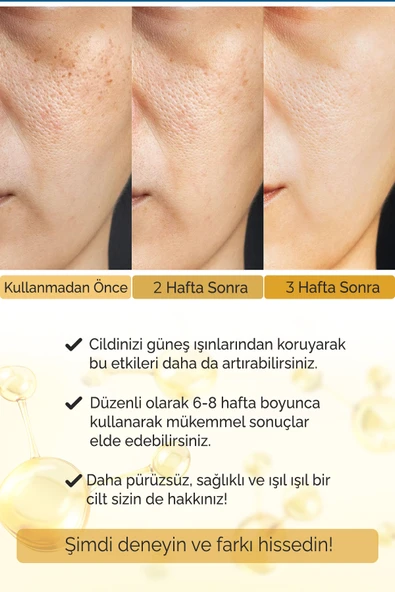 Leke Karşıtı Aydınlatıcı Canlandırıcı Serum BrightFix Series A200 - 5