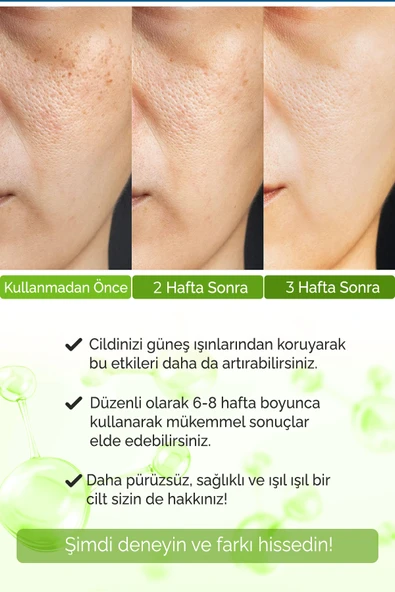 Siyah Nokta Akne Giderici Gözenek Sıkılaştırıcı Vivo Series A210 - 4