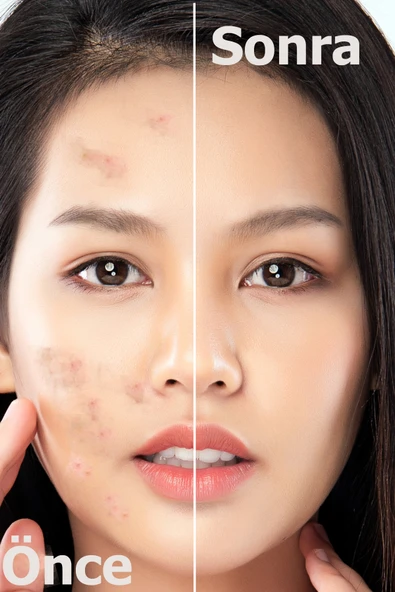 Leke Karşıtı Aydınlatıcı Canlandırıcı Serum BrightFix Series A200 - 12