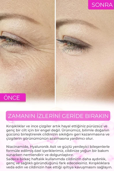 Sivilce Karşıtı,Siyah Nokta,Akne Giderici Sérum Elixir Series A260 - 6