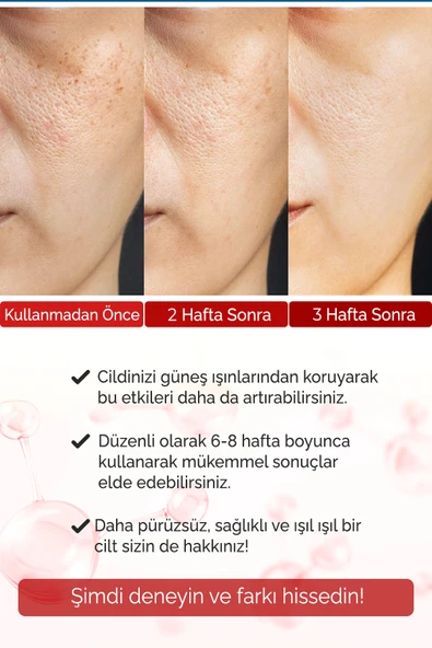 Yaşlanma Karşıtı Kırışık Önleyici Botox Etkili Collagène Premium Serum Vera Series A230 - 6
