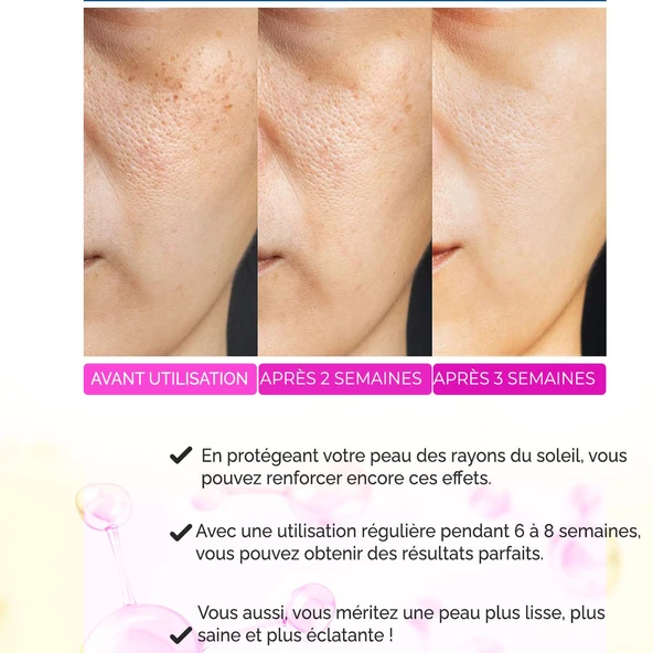 Sérum Anti-Acné, Anti-Points Noirs, Purifiant – Elixir Series A260 - Resim 3