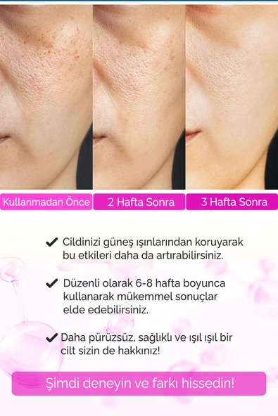 Sivilce Karşıtı,Siyah Nokta,Akne Giderici Sérum Elixir Series A260 - 4
