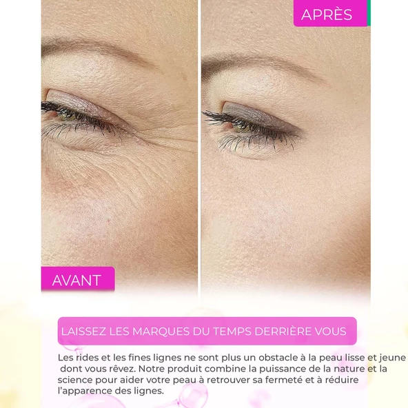 Sérum Anti-Acné, Anti-Points Noirs, Purifiant – Elixir Series A260 - Resim 6