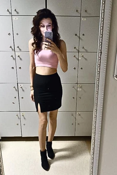Mini Etek Ön Sol Diz Üstü Yırtmaçlı - 4
