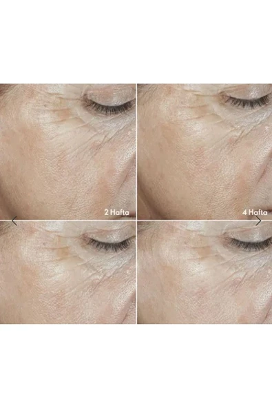 ORİFLAME Novage+ Wrinkle Smooth Rutini Cilt Bakım Seti - 3