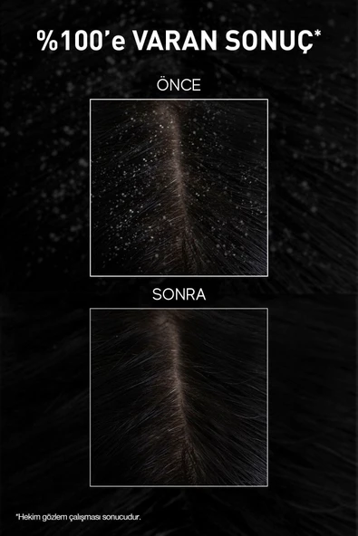 Aqua Thermal Kepek Karşıtı Şampuan 300ml Tüm Saç Tipleri - Resim 7