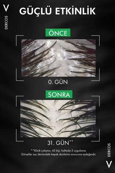 Vichy Dercos Kepek Şampuanı Kuru Saçlar 390 ML - Resim 4