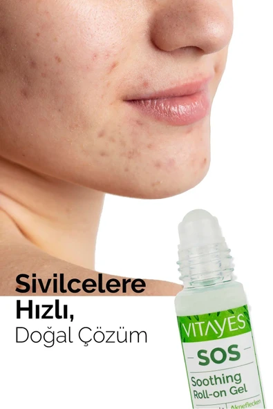 VITAYES Sos Serum Sivilce Siyah Nokta Akne Sinek Isırması Cilt Problemi Onarıcı Çay Ağacı Yağı Cilt Serumu - 2